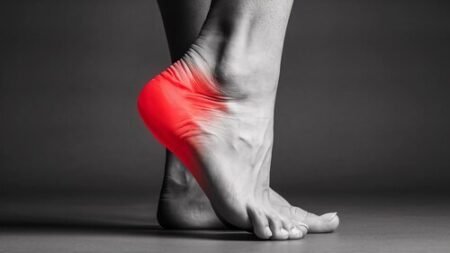 Trn v peti (trn petnice): Vse, kar morate vedeti!